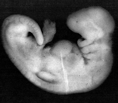 somites at the back of the embryo