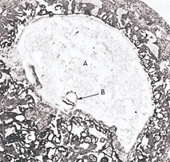 suspension of an embryo